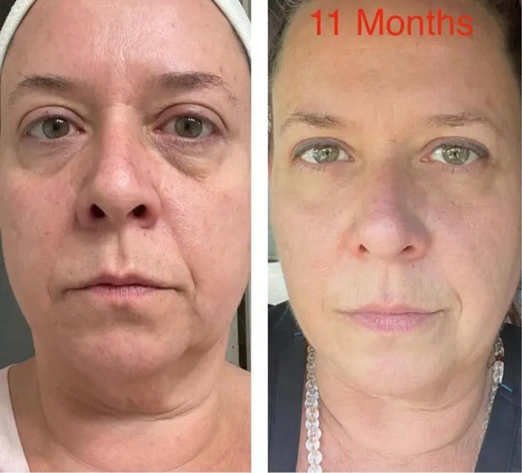 نمونهای از نمایش تغییرات در پروژههای ساختوساز با استفاده از جداکننده بصری